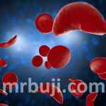 Sickle Cell Disease
