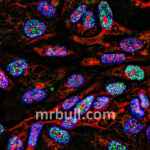 extrachromosomal DNA