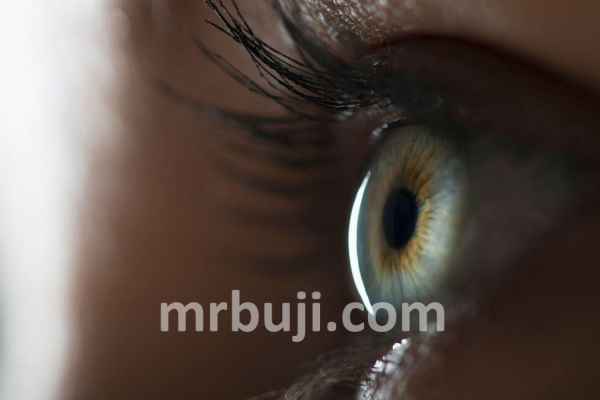 A rare genetic eye disorder.