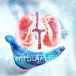 A kidney disorder causing excessive protein in urine