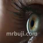 A rare genetic eye disorder.